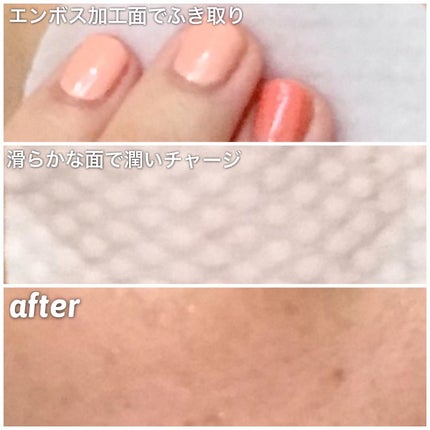 ワンステップモイスチャーアップパッド/COSRX/トナーパッドを使ったクチコミ(5枚目)