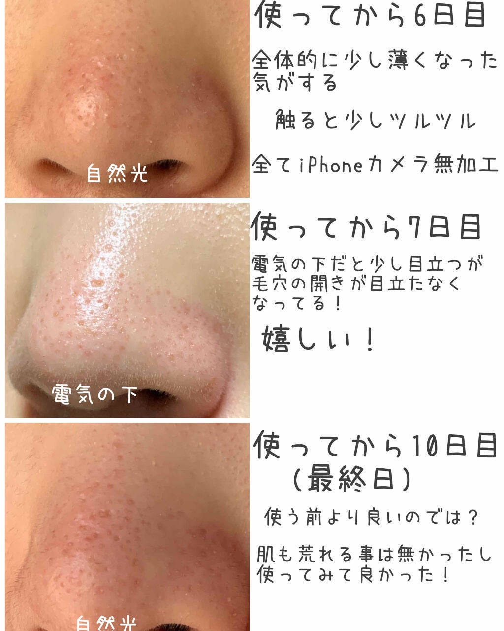 重曹泡洗顔/毛穴撫子/泡洗顔を使ったクチコミ(3枚目)