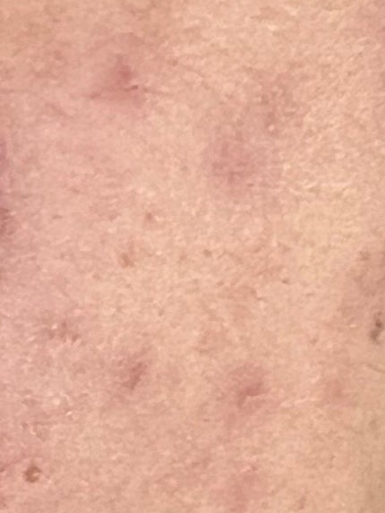 (旧)アンリミテッド ラスティング フルイド 484/shu uemura/リキッドファンデーションを使ったクチコミ(2枚目)