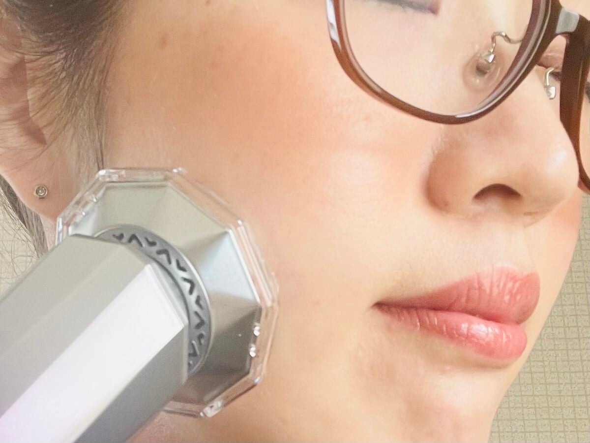 RF温冷美顔器/ANLAN/美顔器・マッサージを使ったクチコミ(3枚目)