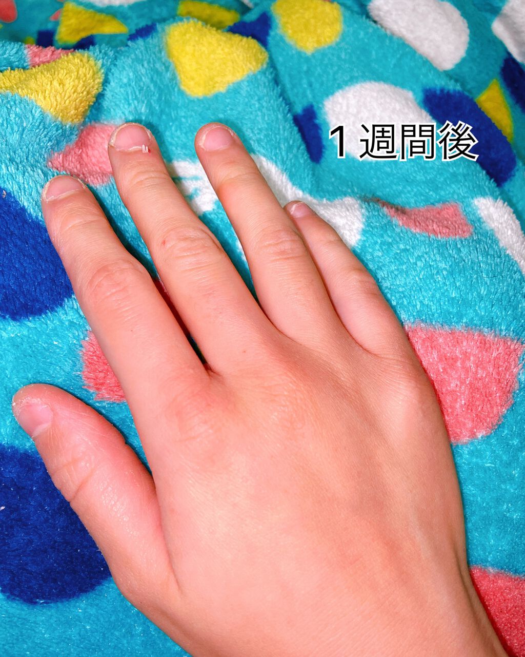 薬用ハンド&フィンガー/ヴァセリン/ハンドクリームを使ったクチコミ(5枚目)