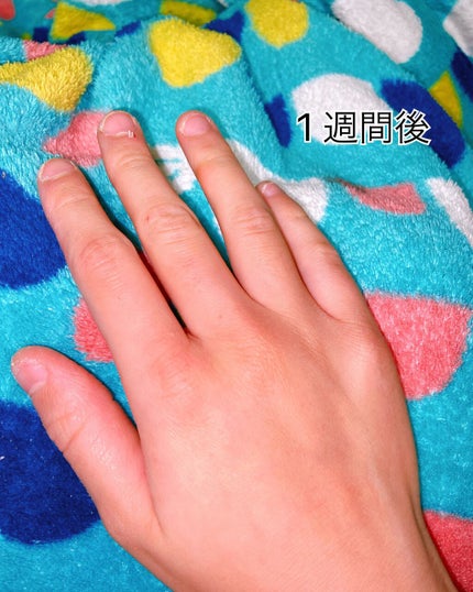 薬用ハンド&フィンガー/ヴァセリン/ハンドクリームを使ったクチコミ(5枚目)