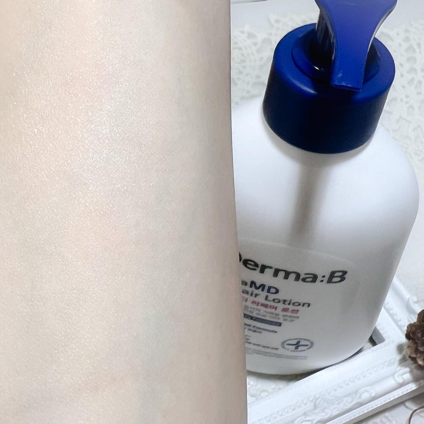 セラMD リペアローション/Derma:B/ボディローションを使ったクチコミ(6枚目)