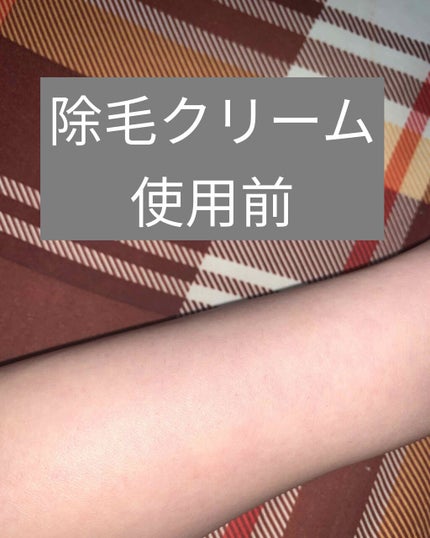 エピプレミアムクリームDX エピプレミアムクリームDXのクチコミ「
⚠️二枚目三枚目⚠️閲覧注意⚠️
医療脱毛で30万のローンを組んでた私が
除毛クリームに.....」(2枚目)