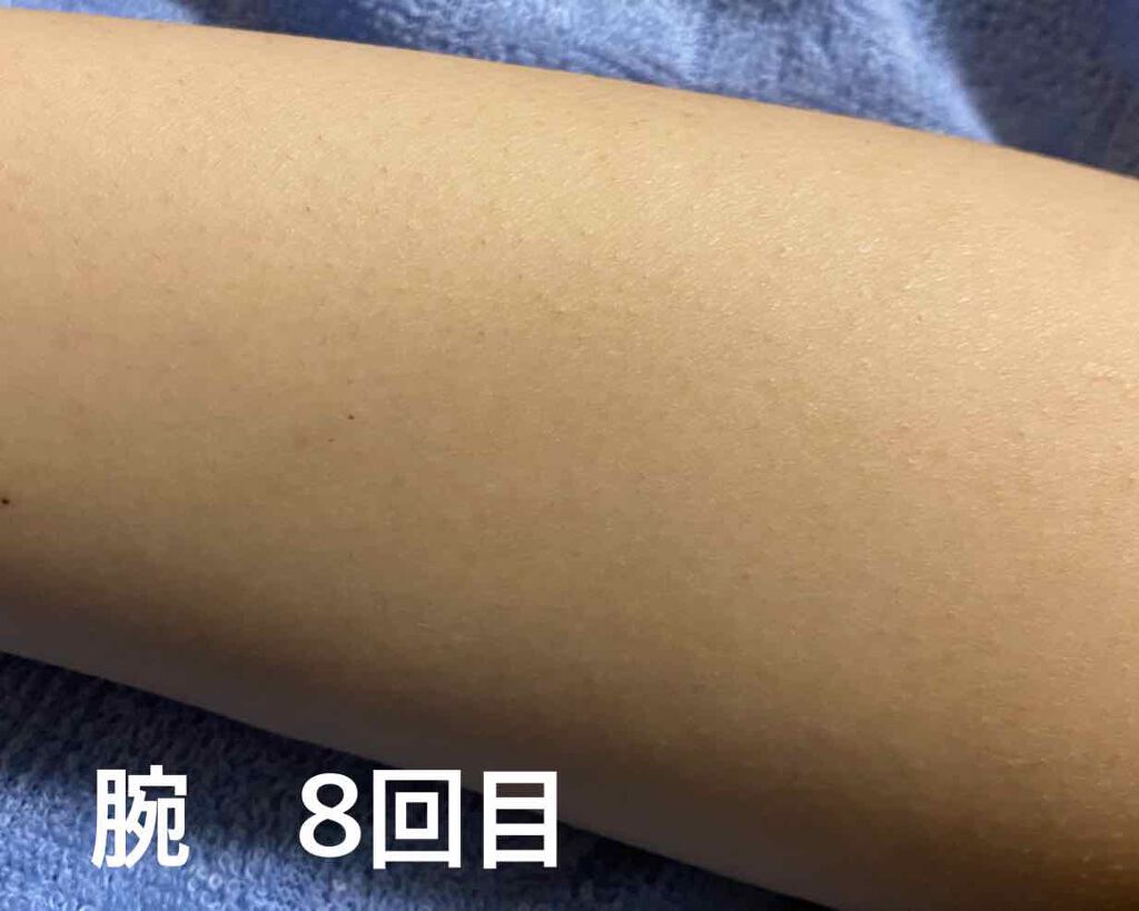 光脱毛器 VIO/Sarlisi/家庭用脱毛器を使ったクチコミ（2枚目）