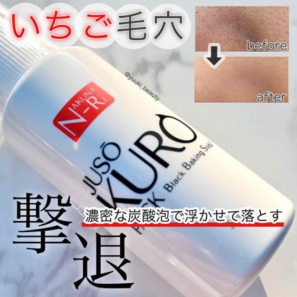 JUSO KURO PACK/NAKUNA-RE/洗い流すパック・マスクを使ったクチコミ(1枚目)