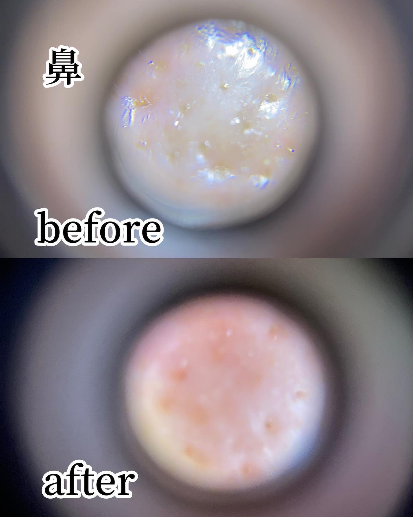 リードルショット300/VT/美容液を使ったクチコミ(6枚目)