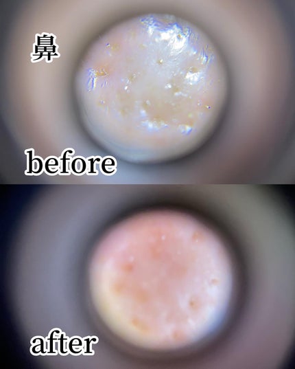 リードルショット300/VT/美容液を使ったクチコミ(6枚目)