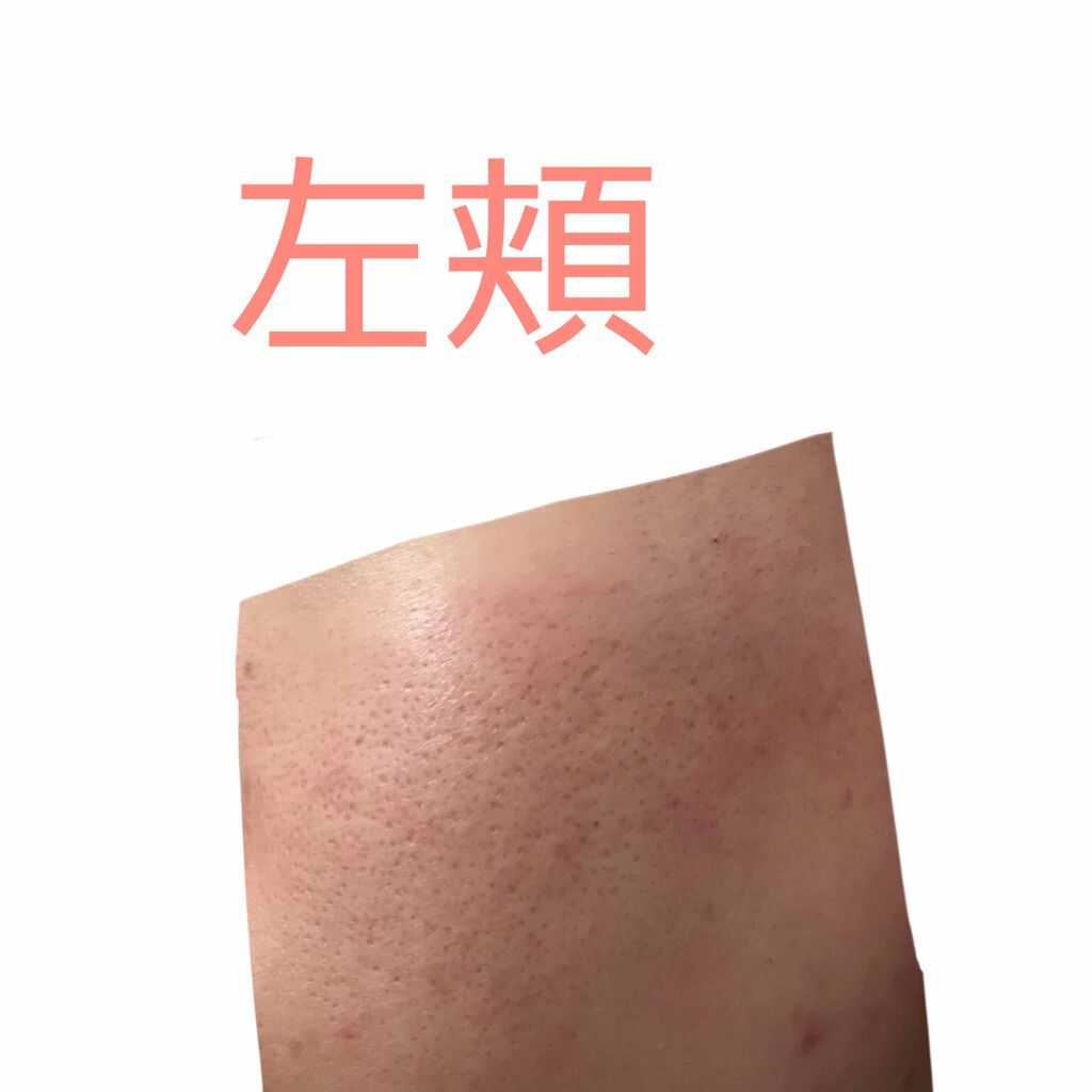 明色美顔水 薬用化粧水/美顔/化粧水を使ったクチコミ（3枚目）