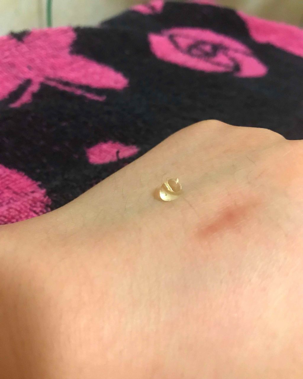 金のプラセンタもっちり白肌濃シワトール/ホワイトラベル/アイケア・アイクリームを使ったクチコミ（2枚目）