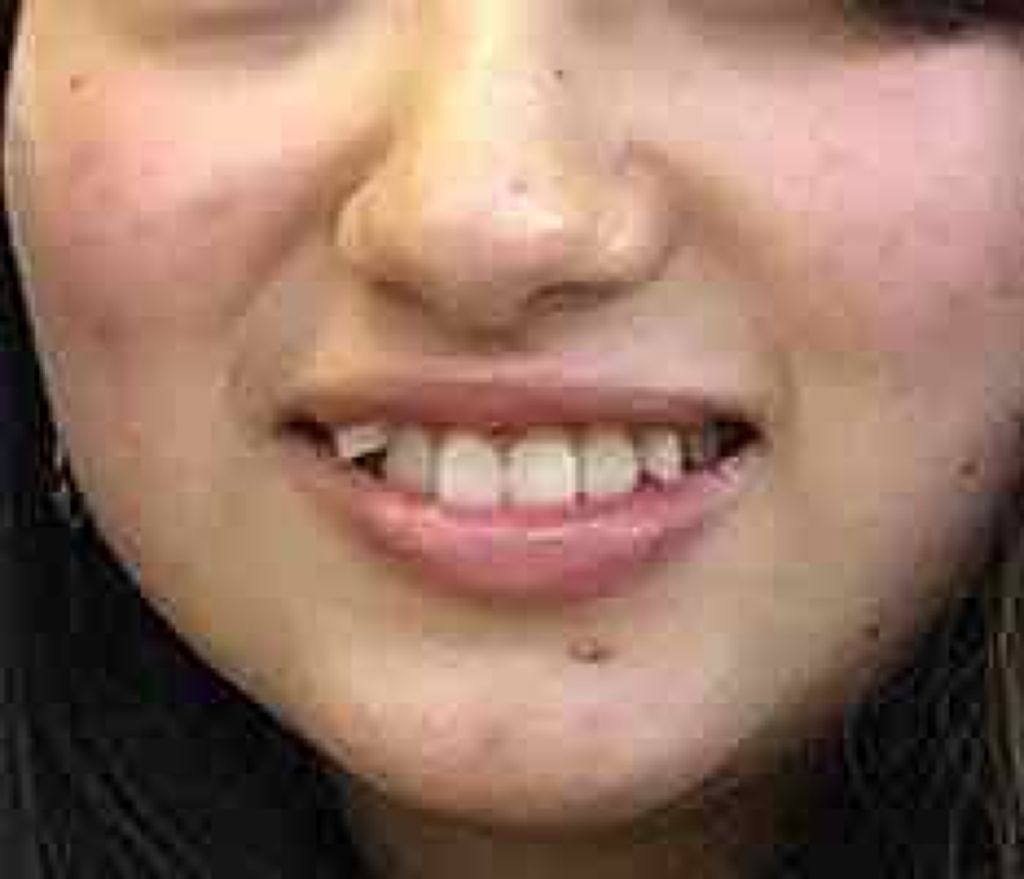 ウオーター/アベンヌ/ミスト状化粧水を使ったクチコミ(2枚目)