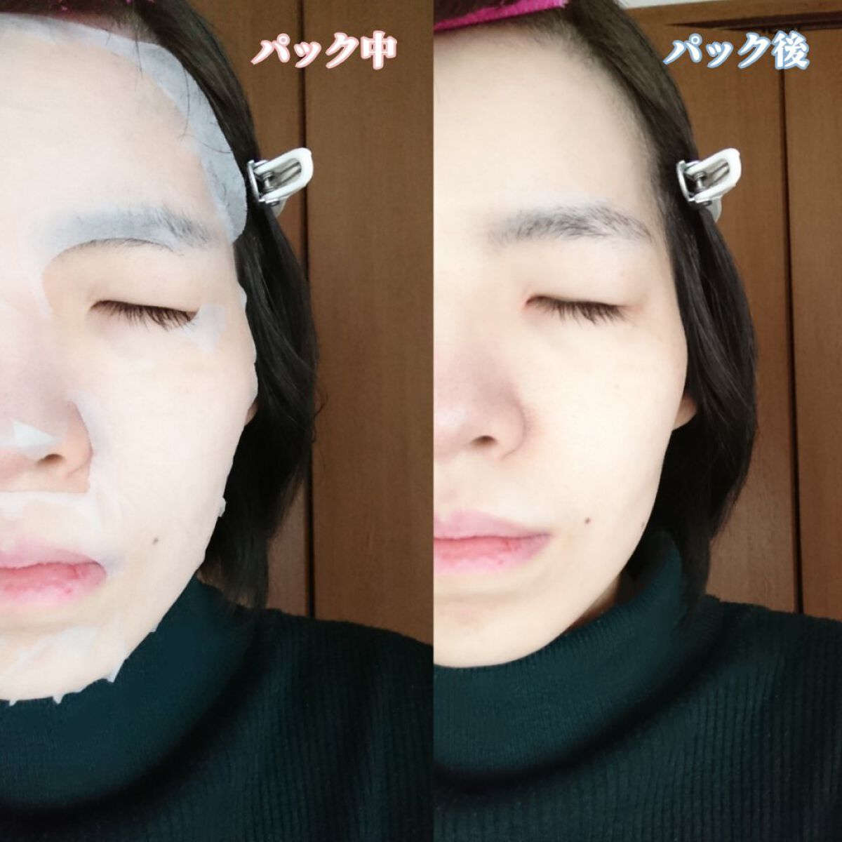 ウォーターモイスチャーアップパッド/Sugar Lab/トナーパッドを使ったクチコミ(3枚目)