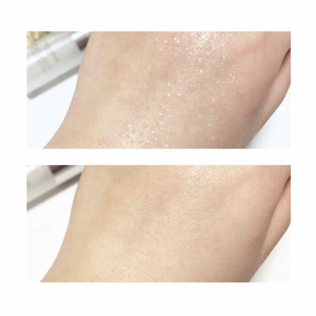 アレルバリア ミスト/d プログラム/ミスト状化粧水を使ったクチコミ(2枚目)