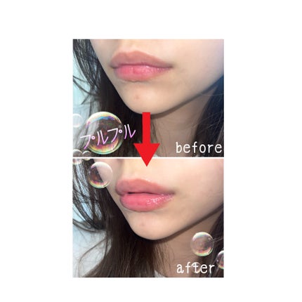 エッセンス リッププランパー/Visée/リッププランパーを使ったクチコミ(1枚目)