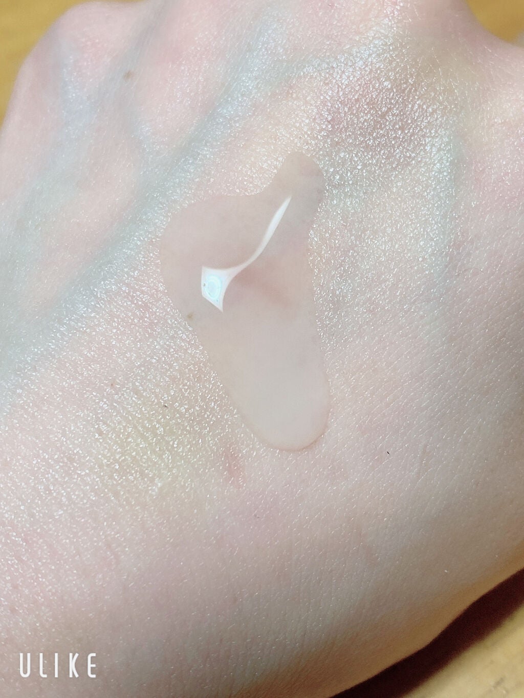 モイスチュア ローション/カルテHD/化粧水を使ったクチコミ(2枚目)