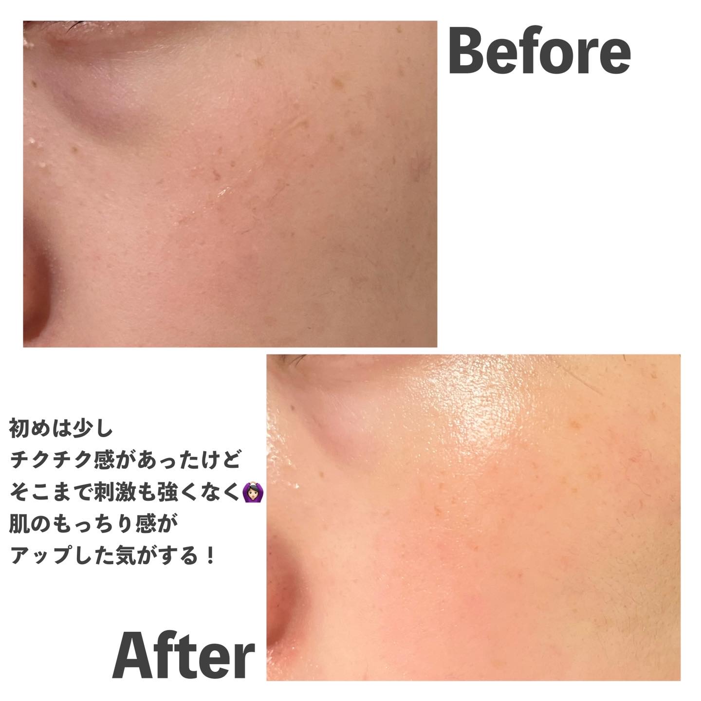 PDRNショット675/COSNORI/美容液を使ったクチコミ（3枚目）