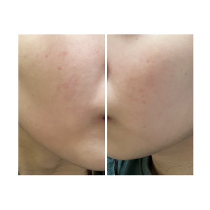 を使ったクチコミ(1枚目)