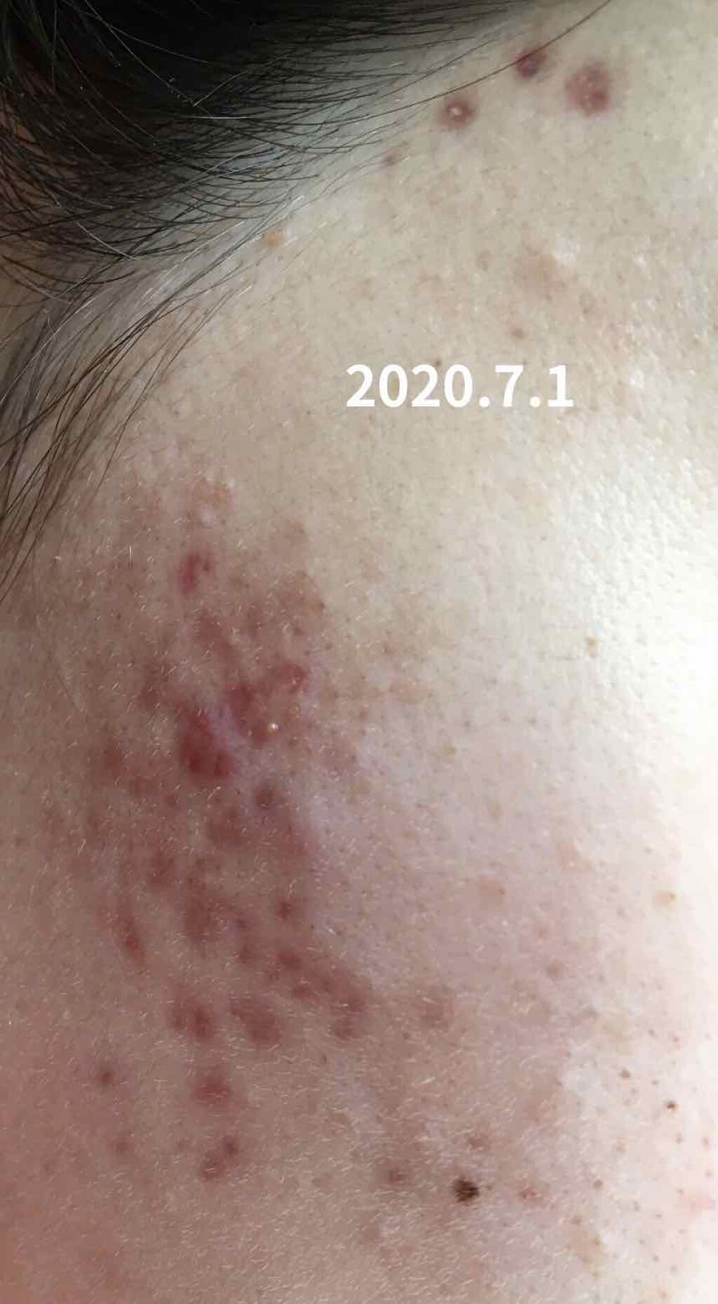 クレイウォッシュ/b.glen/洗顔フォームを使ったクチコミ（2枚目）