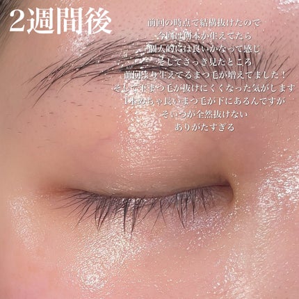 FEG  Eyelash  Enhancer/FEG/まつげ美容液を使ったクチコミ(3枚目)