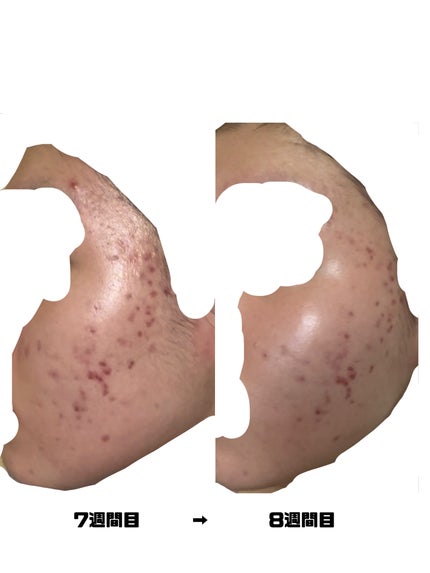 を使ったクチコミ(2枚目)