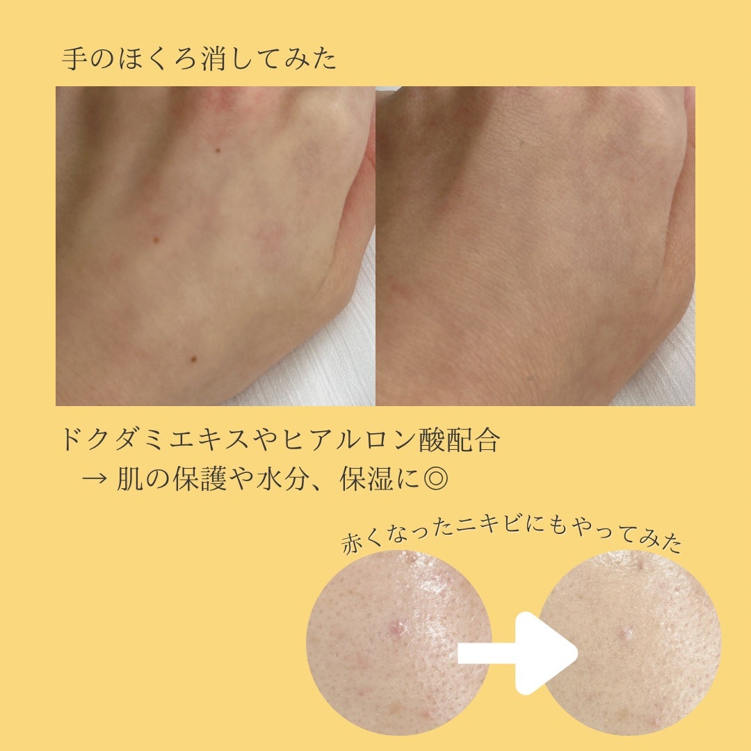 ダーマシンコンシーラー/23years old/リキッドコンシーラーを使ったクチコミ(4枚目)