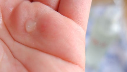 フェイシャル トリートメント エッセンス/SK-II/化粧水を使ったクチコミ(2枚目)