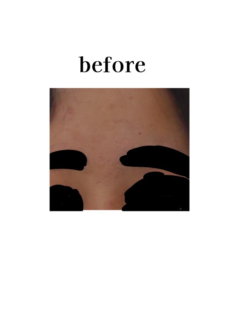 こゆき on LIPS 「❤︎肌断食について❤︎ニキビが気になっていたので、𝙔𝙤𝙪𝙩𝙪𝙗..」(2枚目)