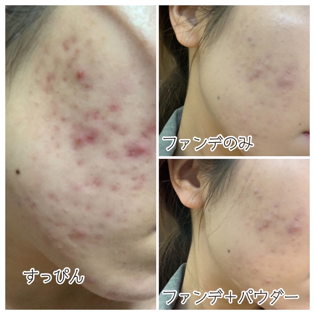 V3 エキサイティングファンデーション/SPICARE/クッションファンデーションを使ったクチコミ（2枚目）