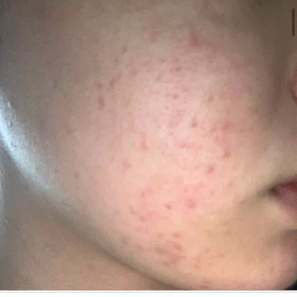 プロポリス エネルギーアンプル/CNP Laboratory/美容液を使ったクチコミ（1枚目）