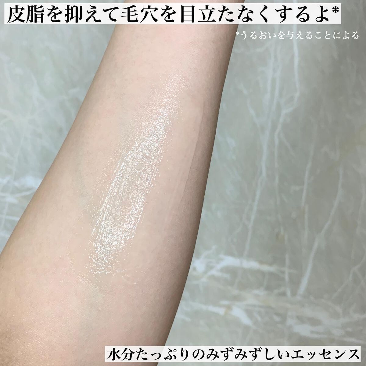 シカレチA エッセンス0.1/VT/美容液を使ったクチコミ(5枚目)