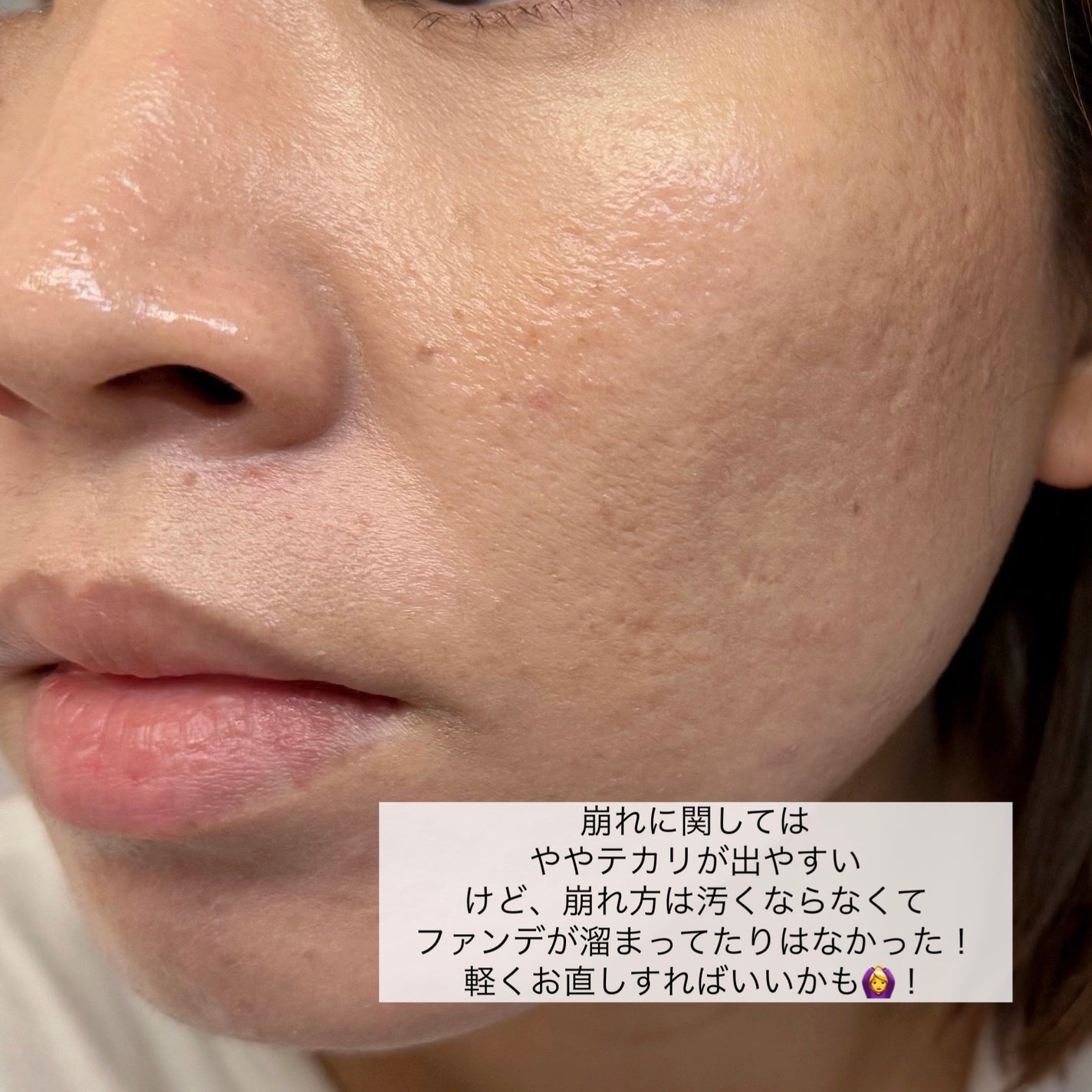 パーフェクティングフィッティング フルカバレッジクッション/LILIBETH/クッションファンデーションを使ったクチコミ(8枚目)