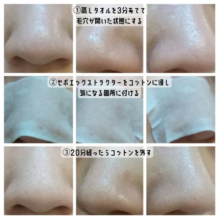 アクレオンセボエクストラクター/ANACIS/その他スキンケアを使ったクチコミ(3枚目)