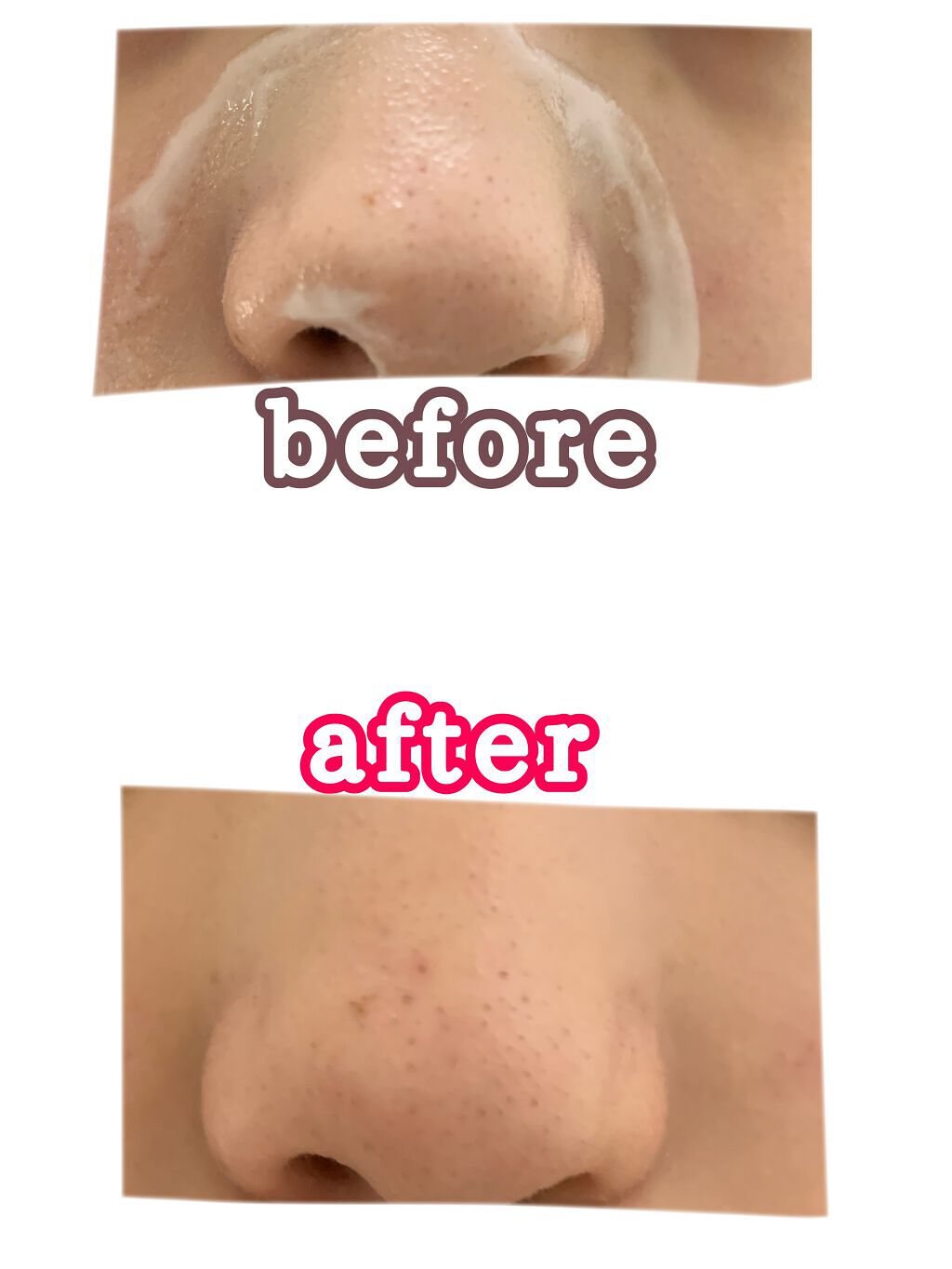 乳液・敏感肌用・高保湿タイプ/無印良品/乳液を使ったクチコミ（3枚目）