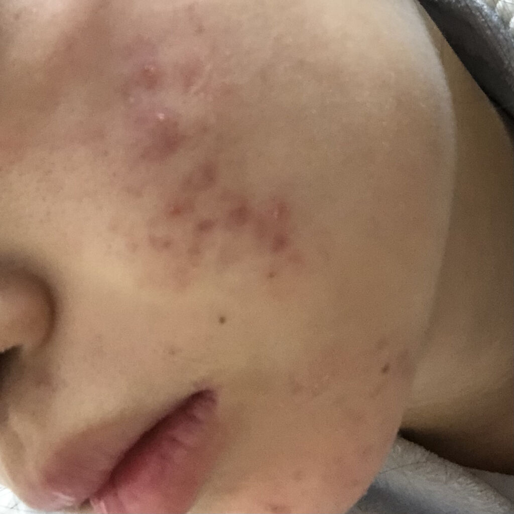 を使ったクチコミ（2枚目）