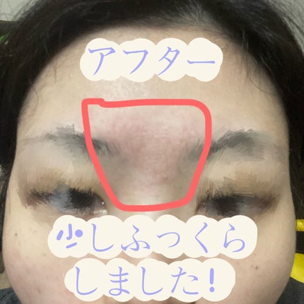 ミケンディープパッチ/北の快適工房/シートマスク・パックを使ったクチコミ(5枚目)