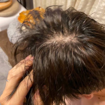 KnS 柿のさち スカルプトニック/マックス/頭皮ローションを使ったクチコミ(4枚目)