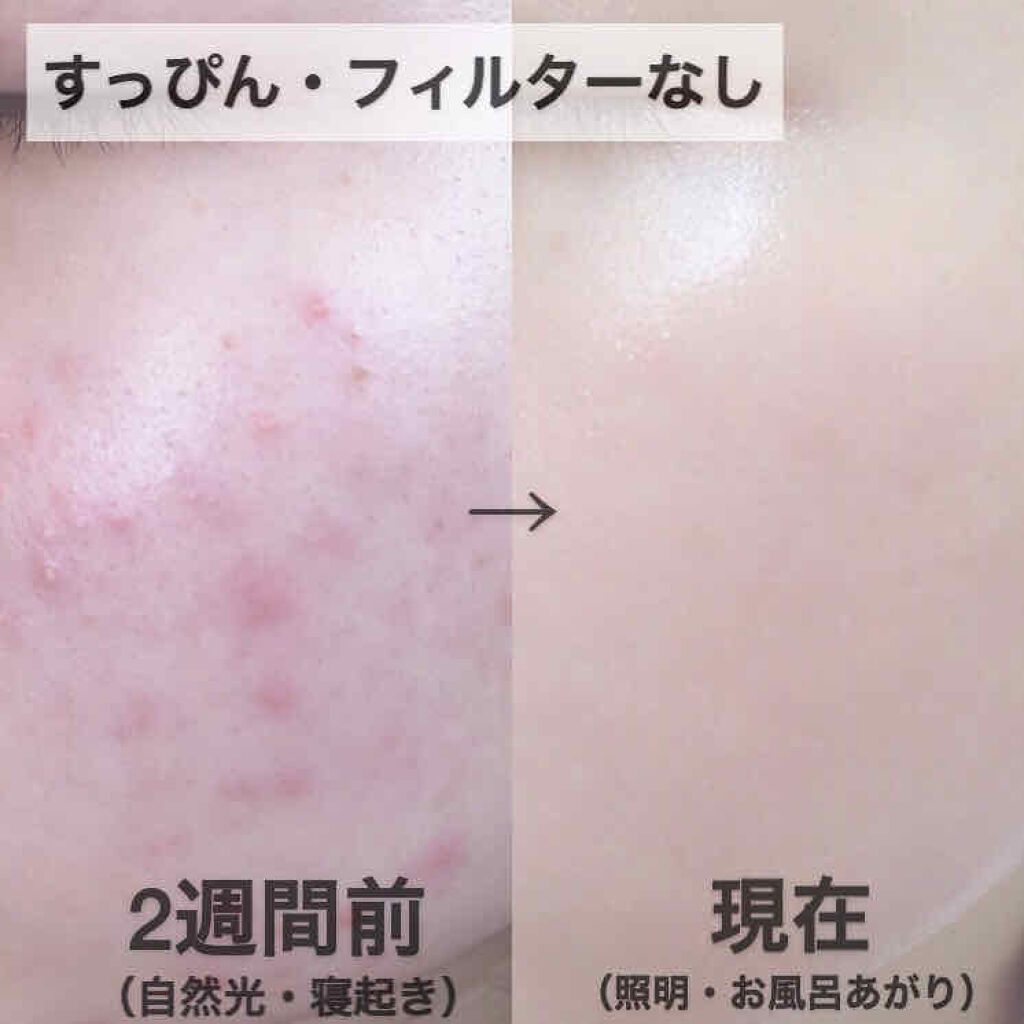 ハトムギ保湿ジェル(ナチュリエ スキンコンディショニングジェル)/ナチュリエ/美容液を使ったクチコミ（2枚目）