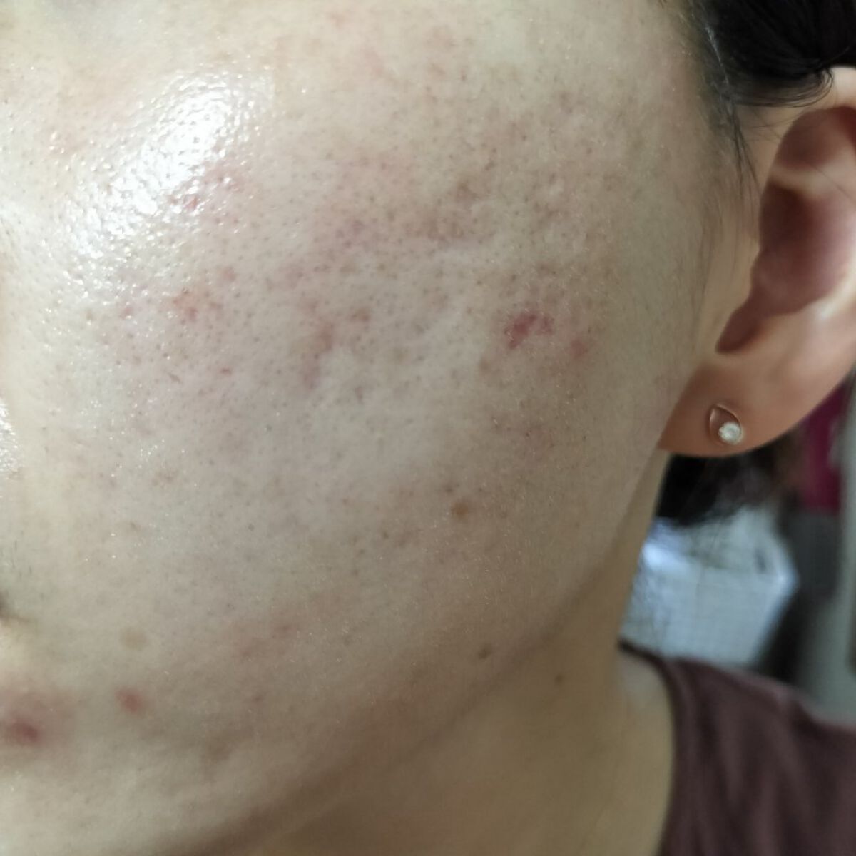 100LAAインパウダー/The Ordinary/その他スキンケアを使ったクチコミ（2枚目）