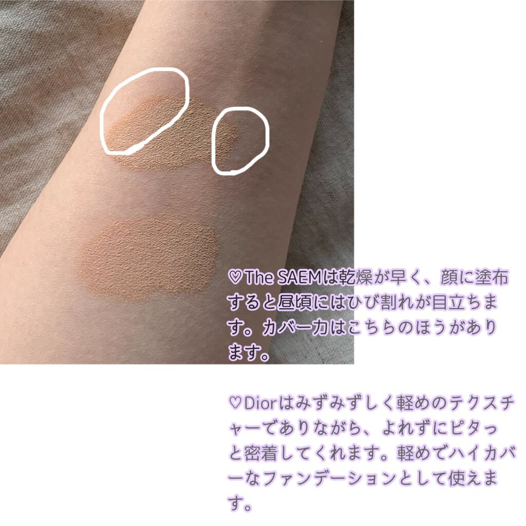 【旧】ディオールスキン フォーエヴァー スキン コレクト コンシーラー/Dior/リキッドコンシーラーを使ったクチコミ(4枚目)