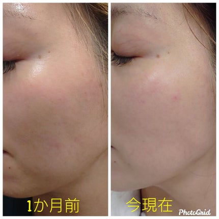 サンホワイトP-1/サンホワイト/ボディクリームを使ったクチコミ(2枚目)