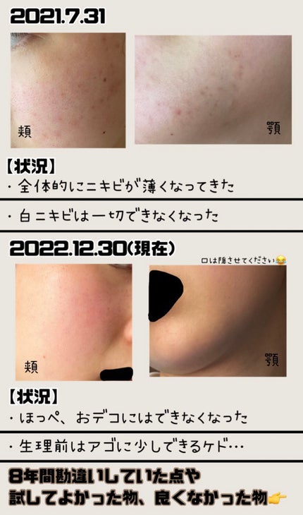 明色美顔水 薬用化粧水/美顔/化粧水を使ったクチコミ(3枚目)