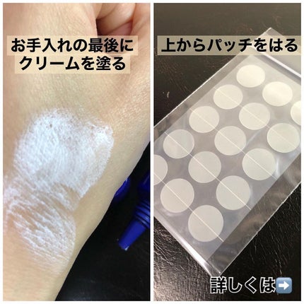 薬用ニキビケア スポッツクリーム/アクネスラボ/フェイスクリームを使ったクチコミ(4枚目)