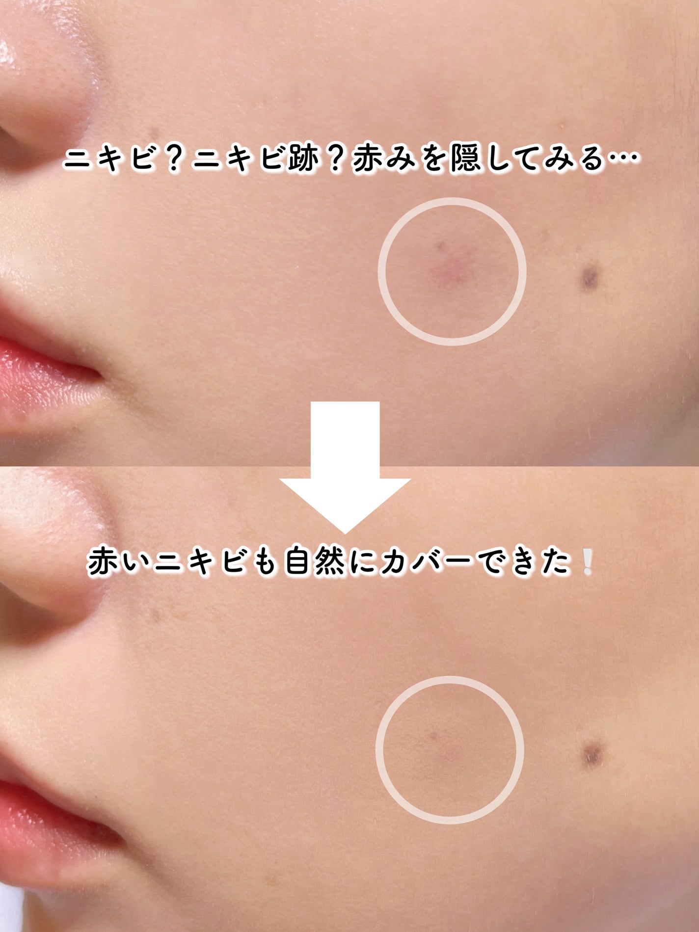 ダーマシンコンシーラー/23years old/リキッドコンシーラーを使ったクチコミ(4枚目)