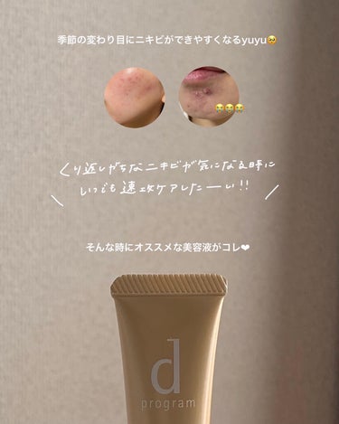 d プログラム 薬用 アクネケア美容液のクチコミ「\ dプログラムから新商品でた /


敏感肌研究50年のd プログラムから
新しく薬用.....」（2枚目）