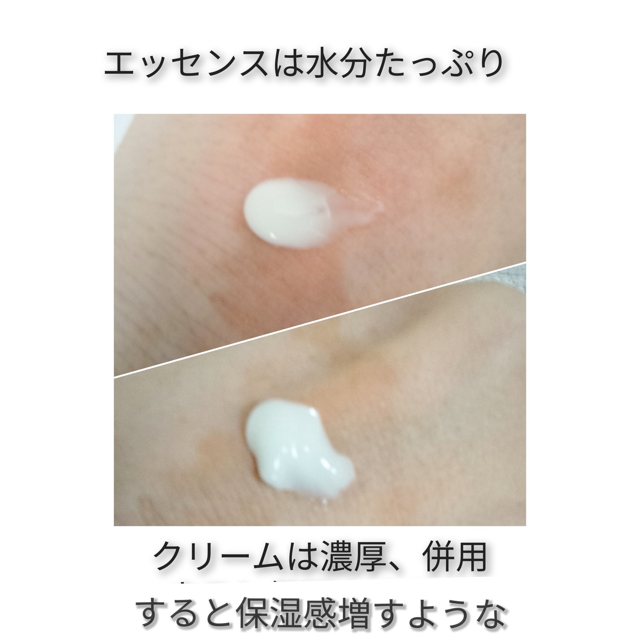 シカレチA クリーム0.05/VT/フェイスクリームを使ったクチコミ（2枚目）