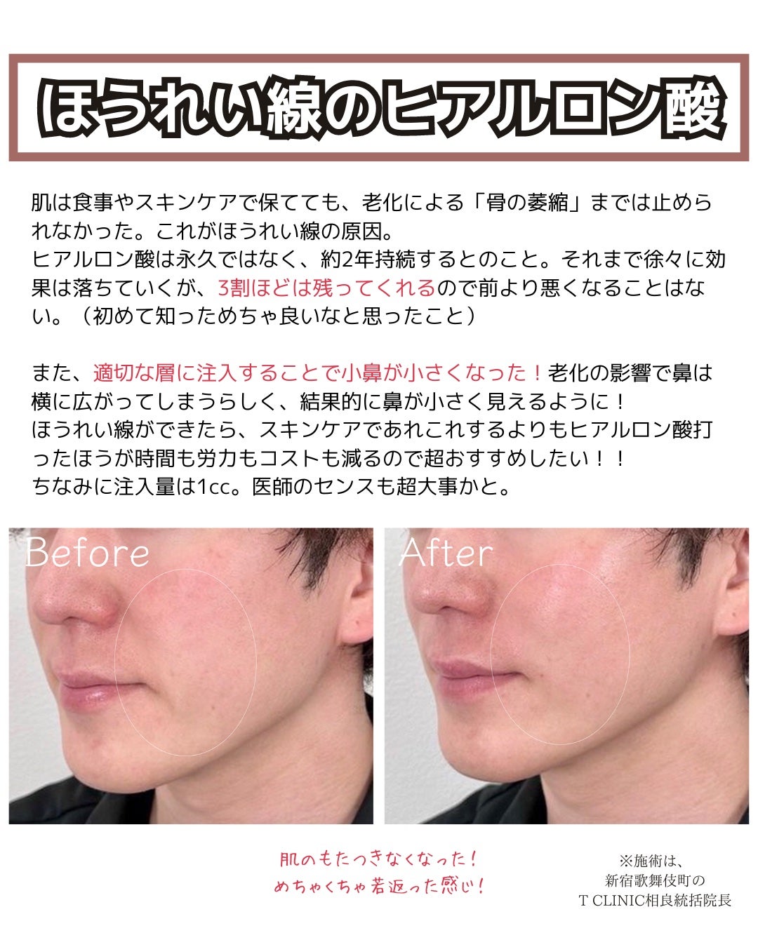 ヒロキ|40歳の美容家 ヘアケア スキンケア on LIPS 「マジで老けたくないのでスキンケア、食事など色々と美容やってきま..」(4枚目)
