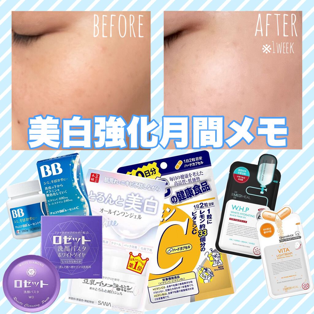 チョコラBB　ルーセントC（医薬品）/チョコラBB/その他を使ったクチコミ（1枚目）