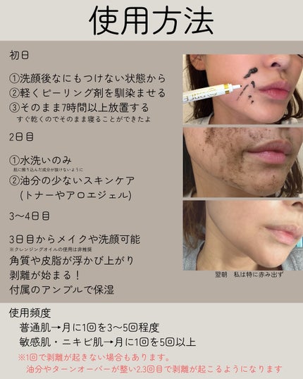 ダーマスキンピーリング/BQCELL/その他キットセットを使ったクチコミ(5枚目)