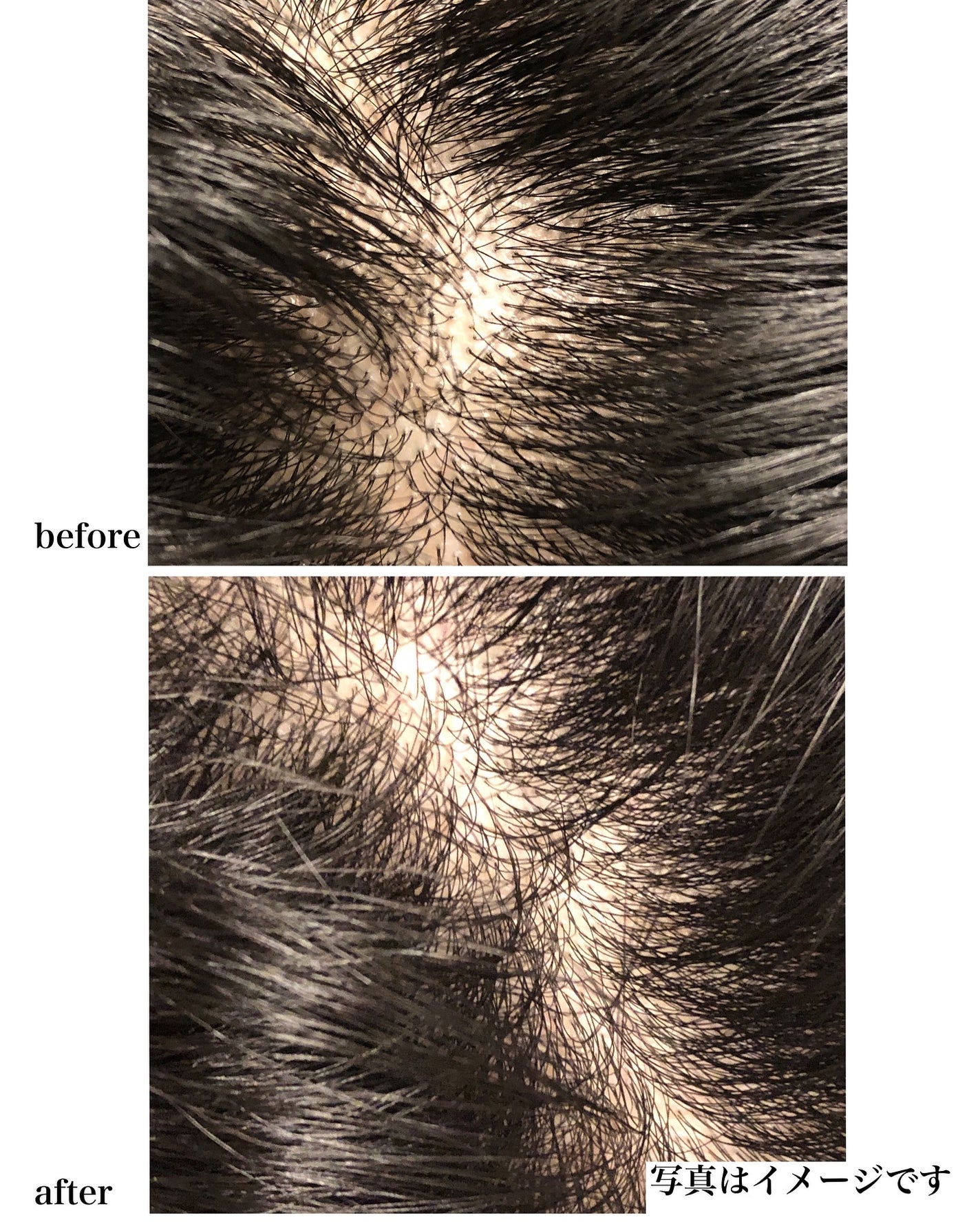 薬用スカルプケアシャンプー/トリートメント モイスト/WELLP/市販シャンプーを使ったクチコミ(9枚目)