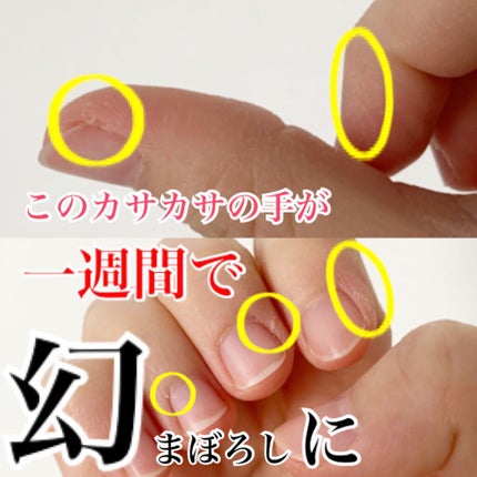 ナイトリニューハンドクリーム/コエンリッチQ10/ハンドクリームを使ったクチコミ(1枚目)
